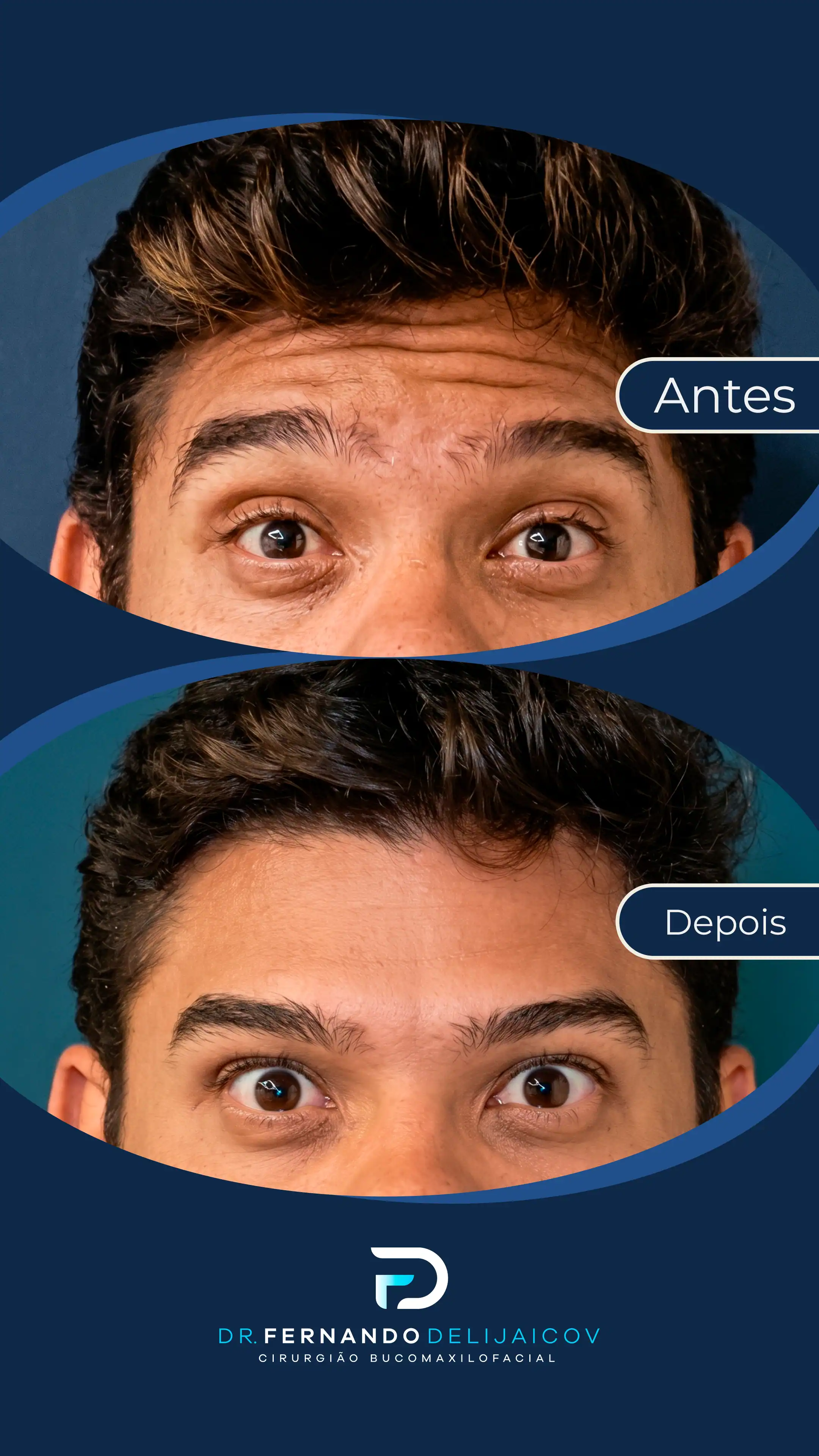Resultado antes e depois 2